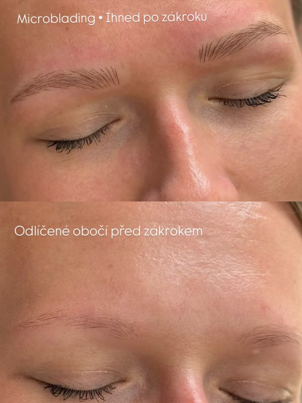 Microblading